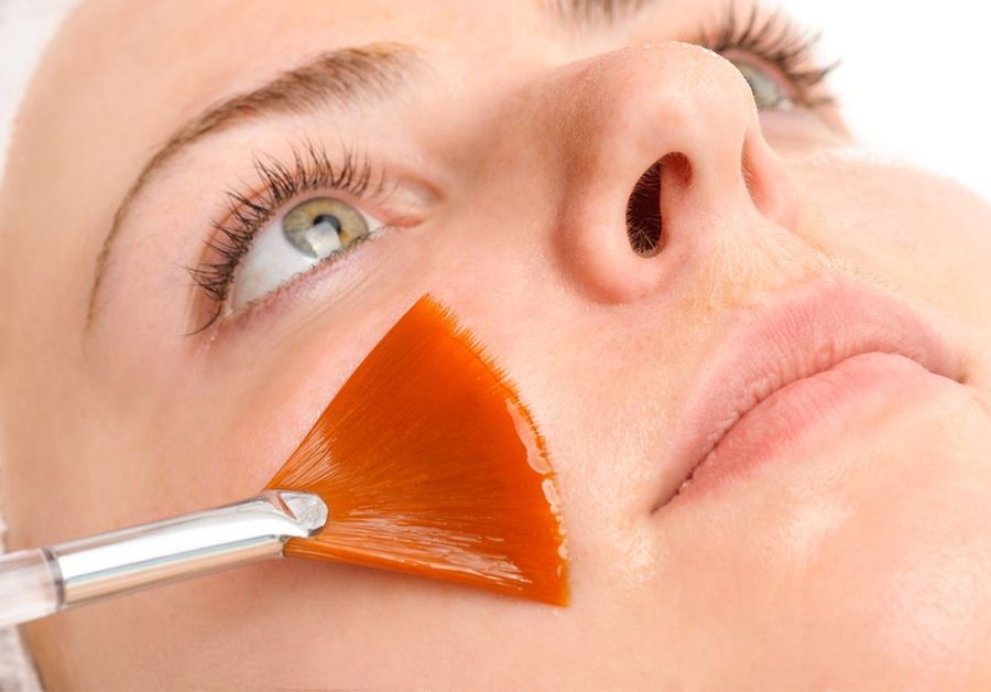 760x1090-peel-6f6cc3c7-240fdea4 Resurfacing Treatments & Dermaplane/Exfoliation - J.Bentley Hair Studio Day Spa | Central Ohio
