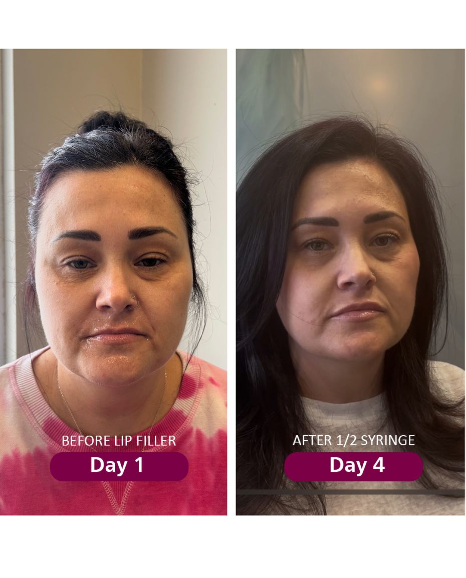 kysse%20filler_no%20words-237cb18f Current Promotions - J.Bentley Hair Studio Day Spa | Powell, OH