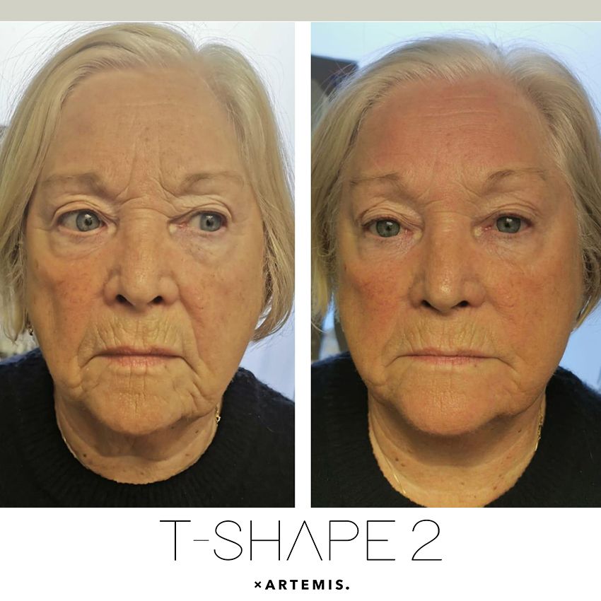 tshape-ba1-286b4233 T-Shape - J.Bentley Hair Studio Day Spa | Powell, OH