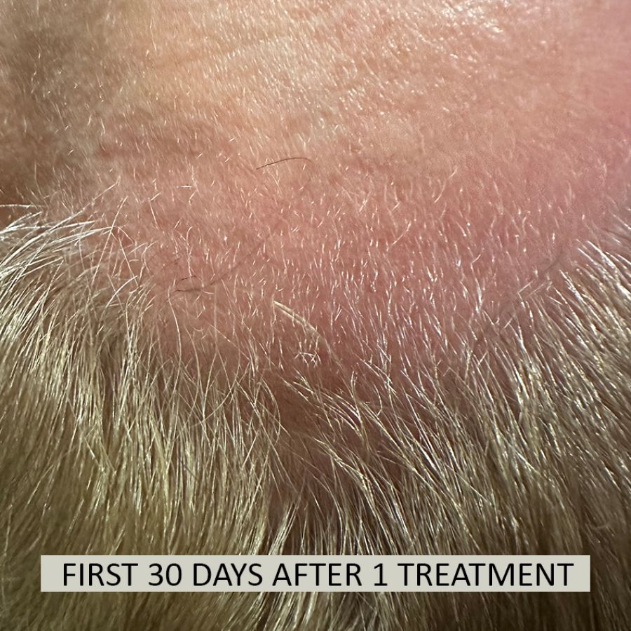 FOLIX%2030%20days-592f46d3 Folix Hair Restoration - J.Bentley Hair Studio Day Spa | Powell, OH