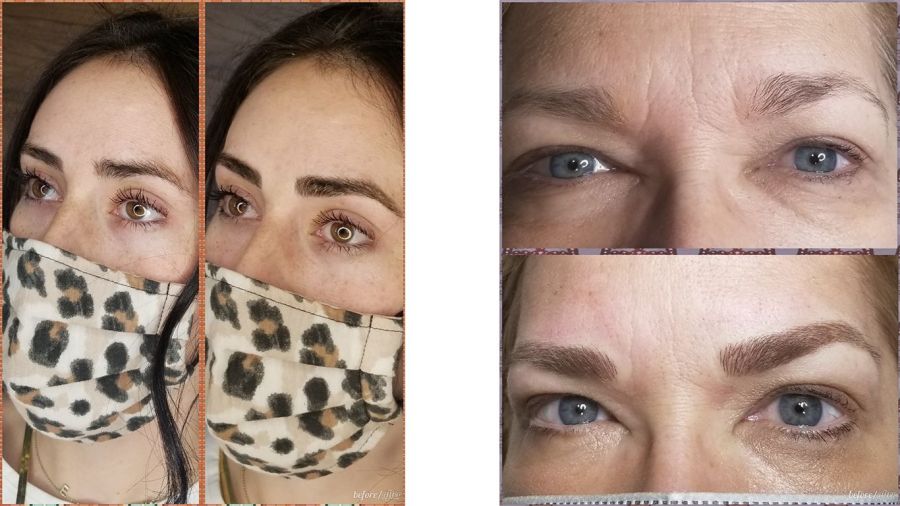 microblade_before-7c06dd6a Microblading - J.Bentley Hair Studio Day Spa | Powell, OH